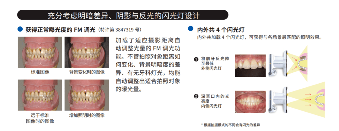 松风病例秀于雪松什么相机口腔专业摄影相机直出高清图正畸拍摄一个人
