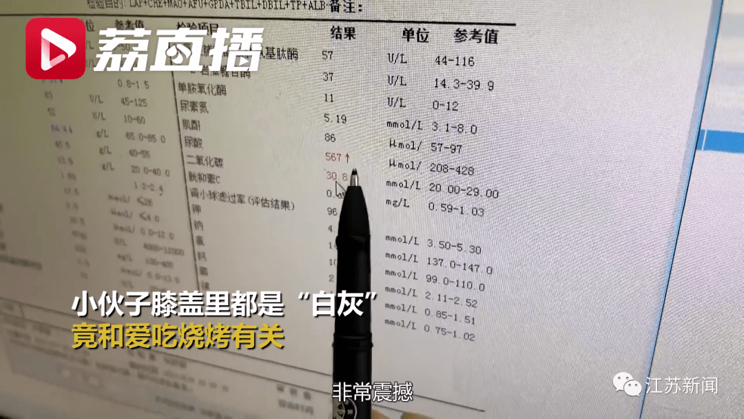 怎么查尿酸正常值是多少 cdfac24272b74c03b063bd032fdfafdc.png