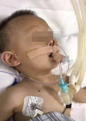 一个炒菜的功夫孩子就没了!儿科医生呼吁:这些底线千万不要让孩子碰!