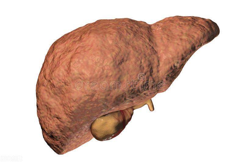抽烟会加速肝脏纤维化离肝癌仅一步之遥一旦查出基本都晚了