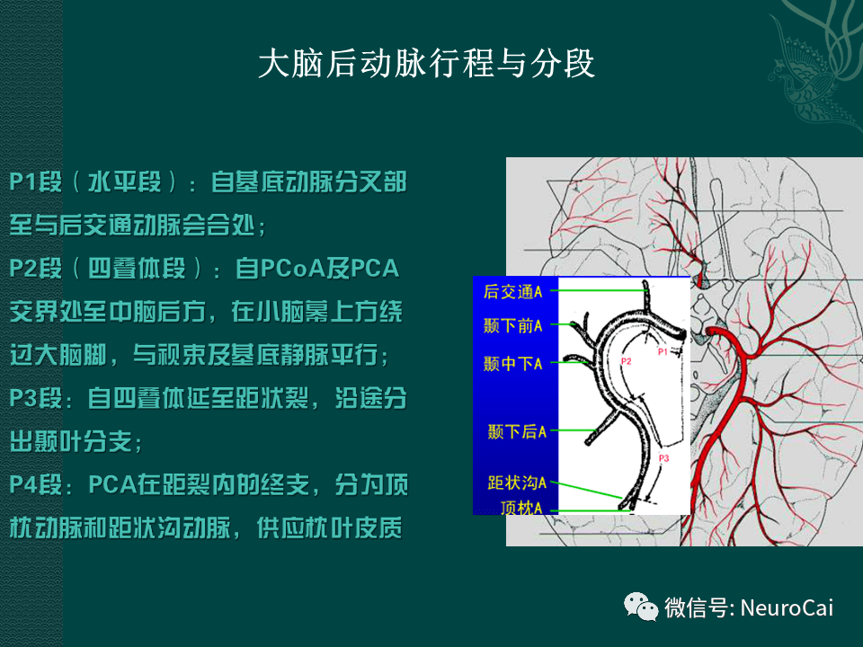 高清图脑动脉解剖与ct重建