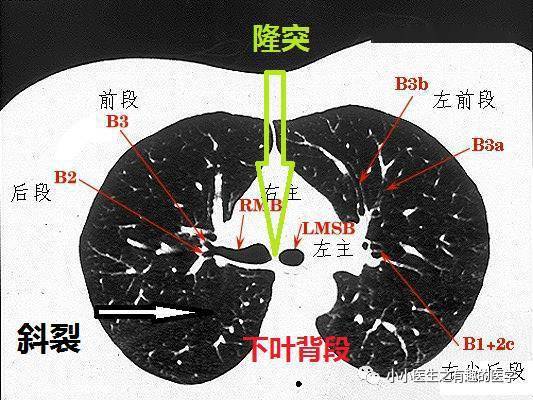 肺下叶的位置图图片