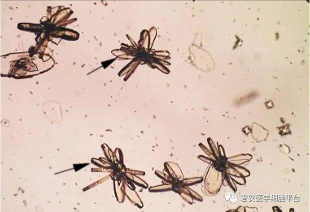 查看答案请报告箭头所指有形成分的名称2021306草酸钙结晶点击空白处