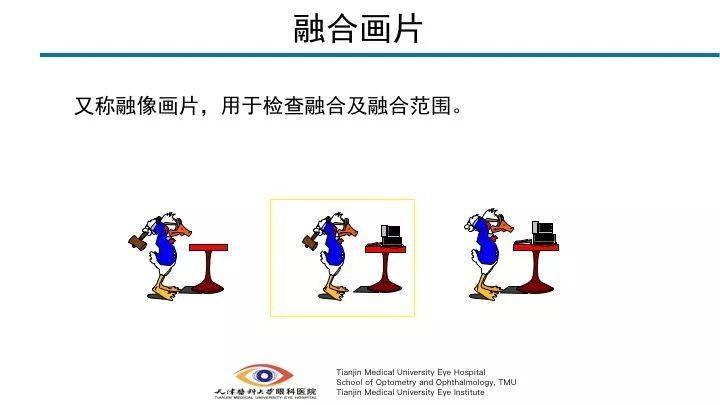 三级视功能包括:同时视,融合和立体视.