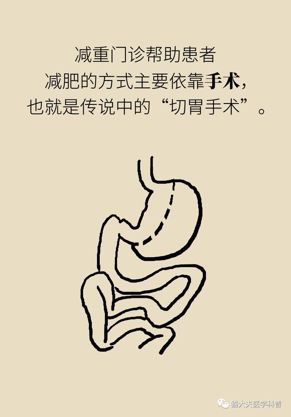腹腔镜|什么样的人能做减重手术？专家：符合这个指标才行