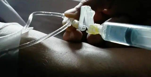 随着麻醉药输入进了自己的体内,小白渐渐的闭上了双眼,可是意外却发生