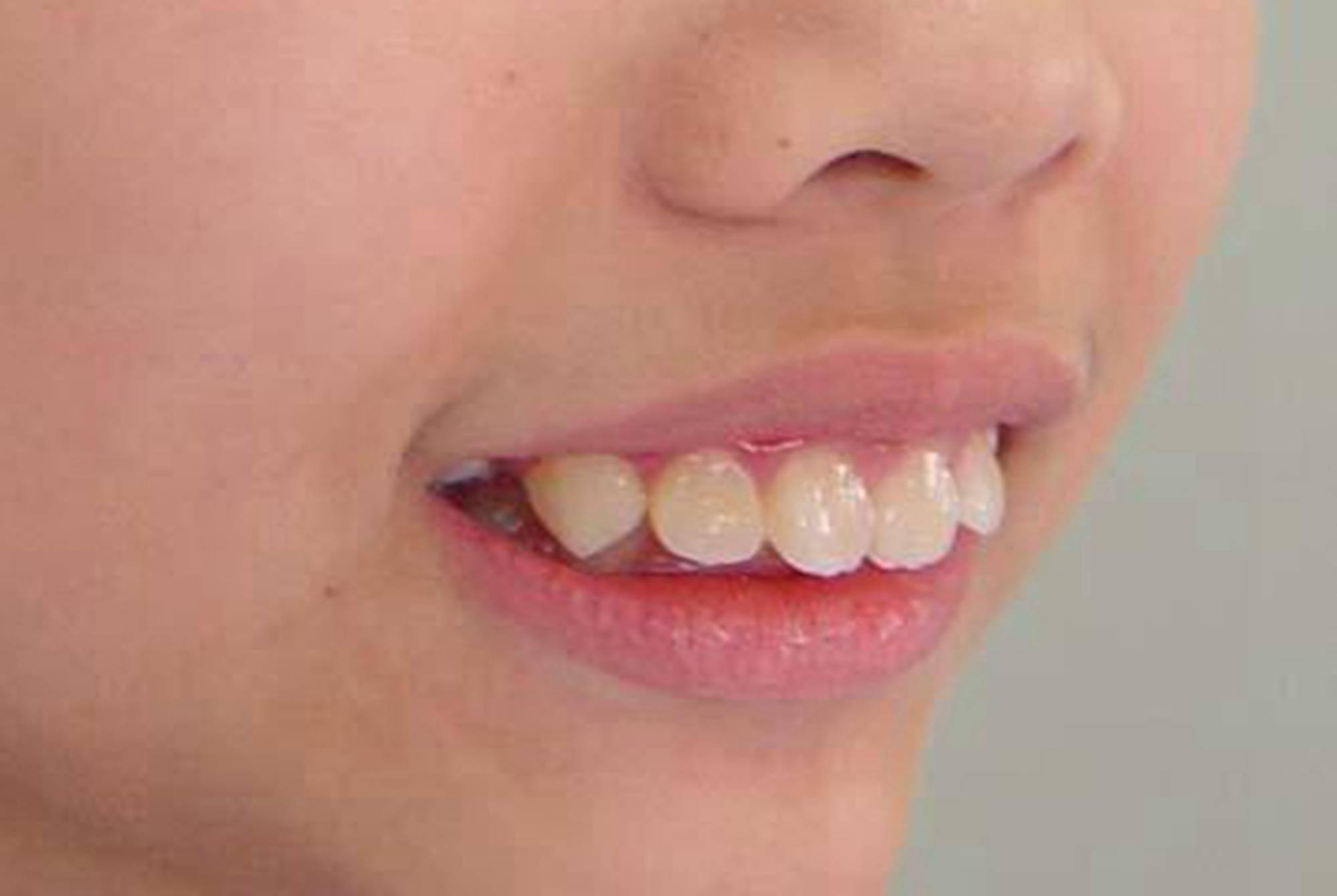 容易毁颜值的六个习惯,宝宝可能每天都在做_牙齿