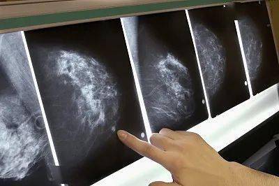 当归柴胡泡水喝30岁的女人多喝能消乳腺增生还补气血