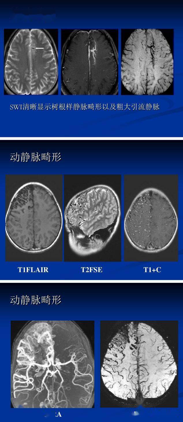 可同时获得幅度图像(magnitude image)和相位图像(phase image)