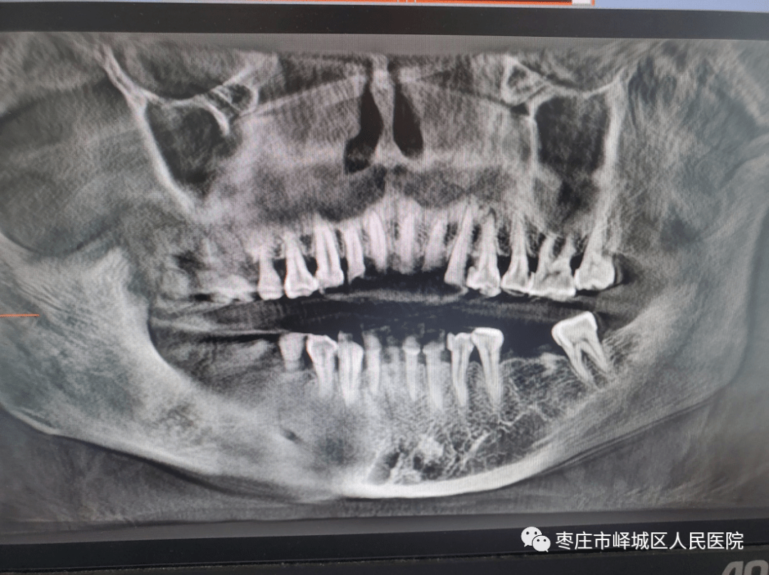 您知道吗口腔也可以做ct哦
