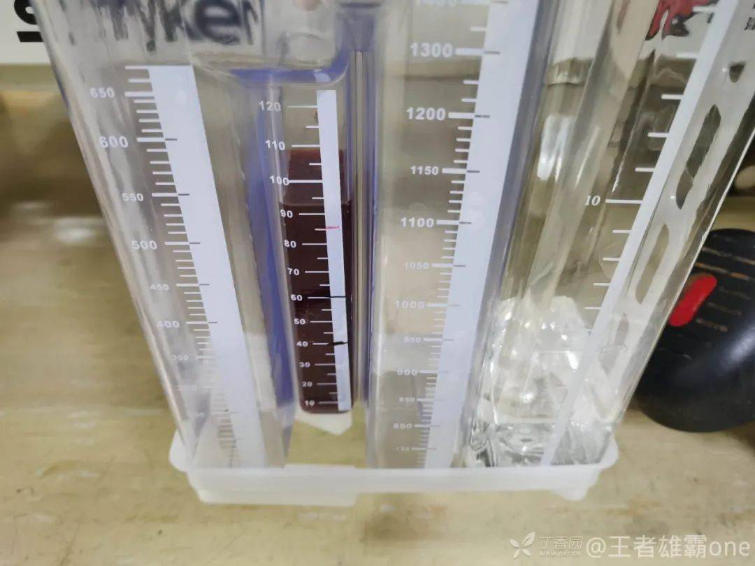 61 岁男性外伤后右侧流出「牛奶」胸水,病因竟是?_乳糜