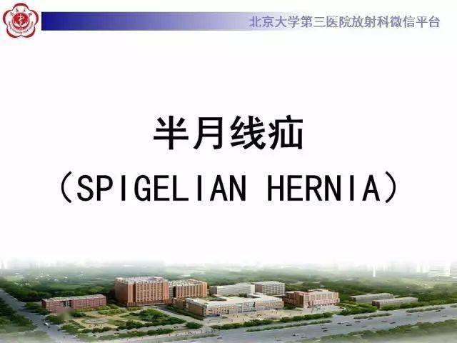 半月线疝(spigelian疝)