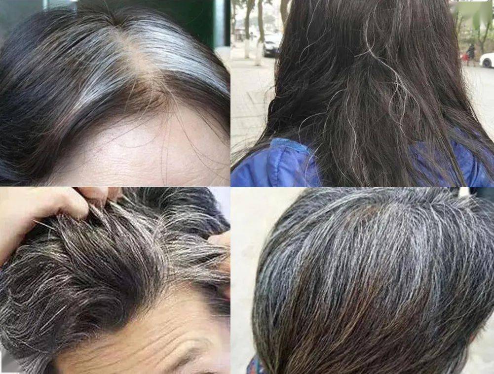 怎么样能长出浓密的秀发 7fc65750223d4200a0b1bcc8ef1db67e.jpeg