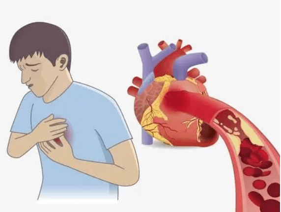 男子|不到10分钟，男子被空调吹倒，心肌梗死！医生叹息：夏天3种行为都是大忌