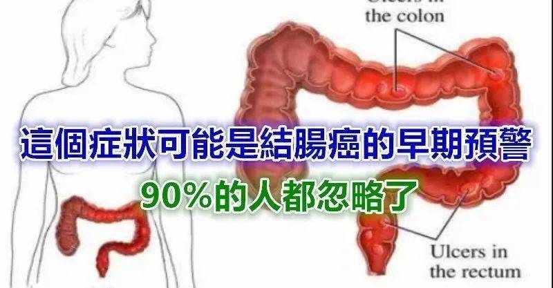 肠癌一发现就是晚期,一般身体这个部位痒,癌细胞已经醒了