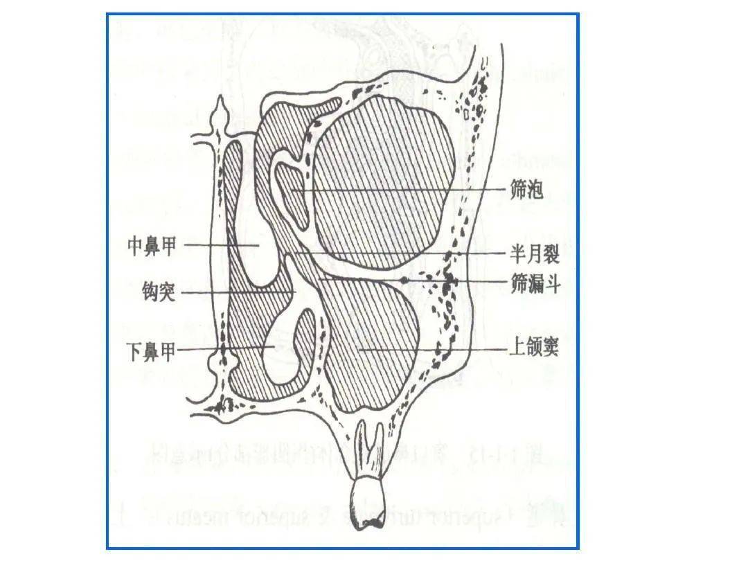 鼻及副鼻竇影像解剖