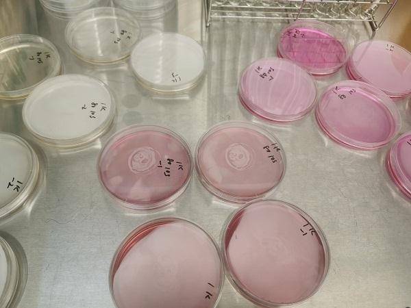 结果|夏天最容易吃坏肚子了！拿热水烫餐具有用伐？专家做了个试验