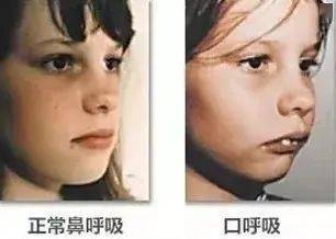 产品|新西兰“国民级”鼻炎品牌：一喷就通，10倍轻柔！小孩都不抗拒的通鼻神器！