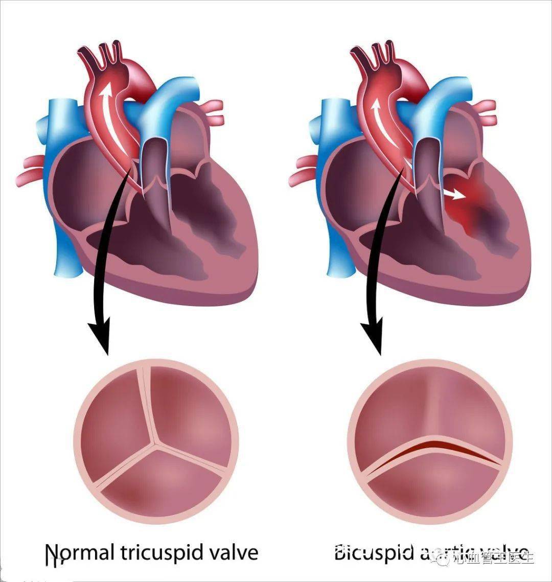 听说心脏病都要终生服药是真的吗心血管王医生给出答案