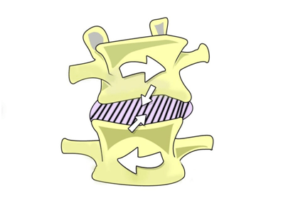 颈椎|关注身体“警报”，就是关注自己的健康