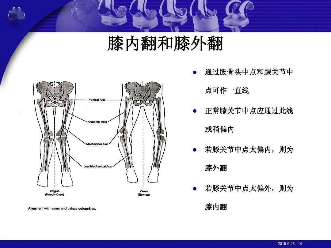 調整姿勢後能完全下蹲或輕度下蹲不全者,陸勤人員合格(臀肌攣縮綜合徵