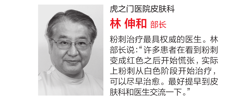 治疗|刘雨昕遮痘磨皮，尹净汉用痘痘贴，对抗粉刺你还需要这些！