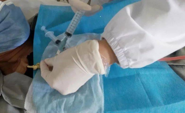 新技术新项目我院血透室开展透析导管内尿激酶溶栓