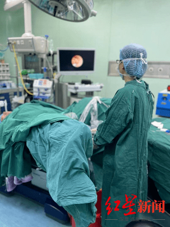 女子|输尿管结石竟能导致脓毒血症？成都女子忽视病情险酿大祸