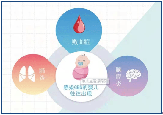 不容忽视的孕期检测项目---b族链球菌_宝宝