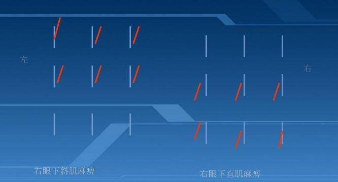 复视像检查图解读图片