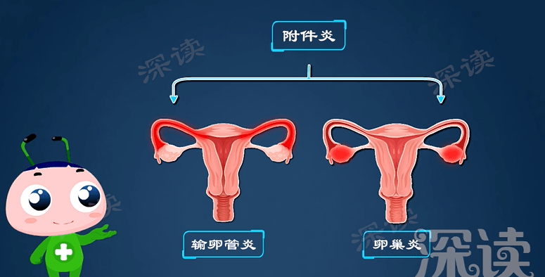 附件炎怎么治疗