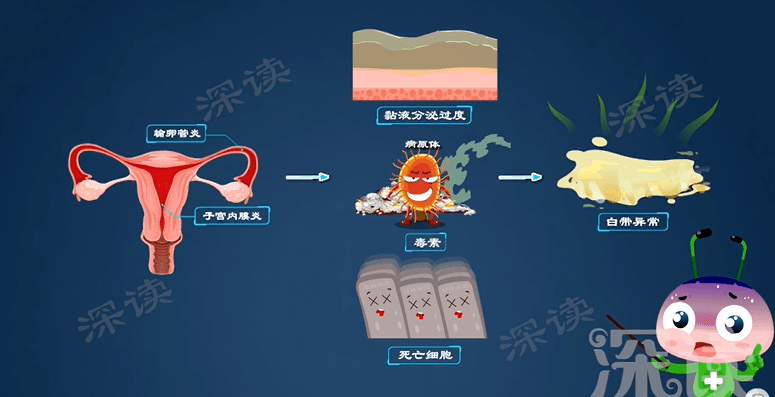 腹部隐痛?白带异常?还会不孕?附件炎危害有多大?硬核科普_输卵管