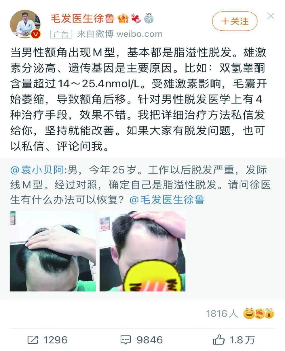 单位|年轻人秃了，这家公司却赚翻了