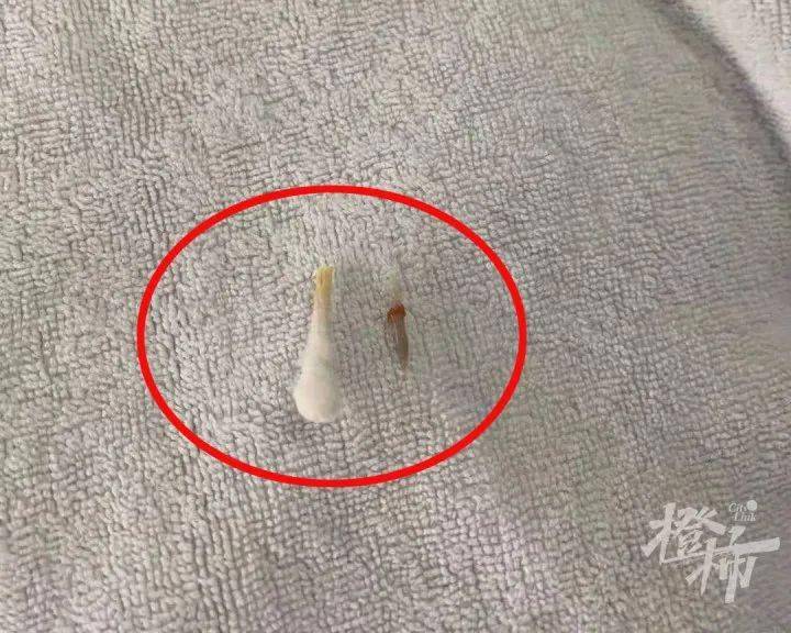 取出的鸡骨头,长约1厘米左右,一头尖锐.