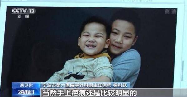 笑脸|医身更医心！外科医生杨科跃：用镜头记录100多名患者愈后笑脸