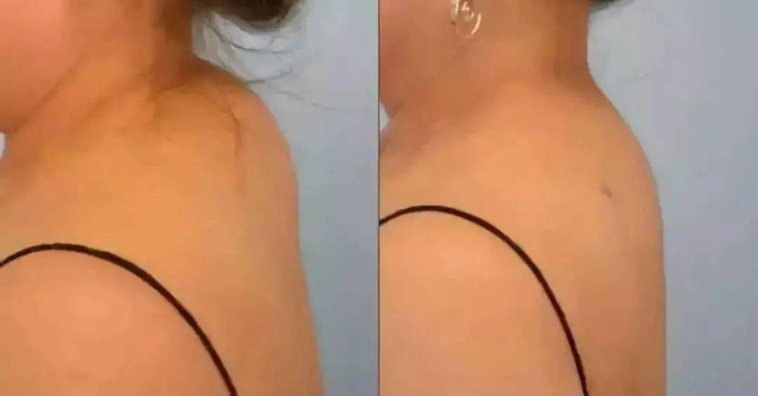 看着富贵的富贵包小心变成夺命包这样做赶走富贵包告别圆肩驼背