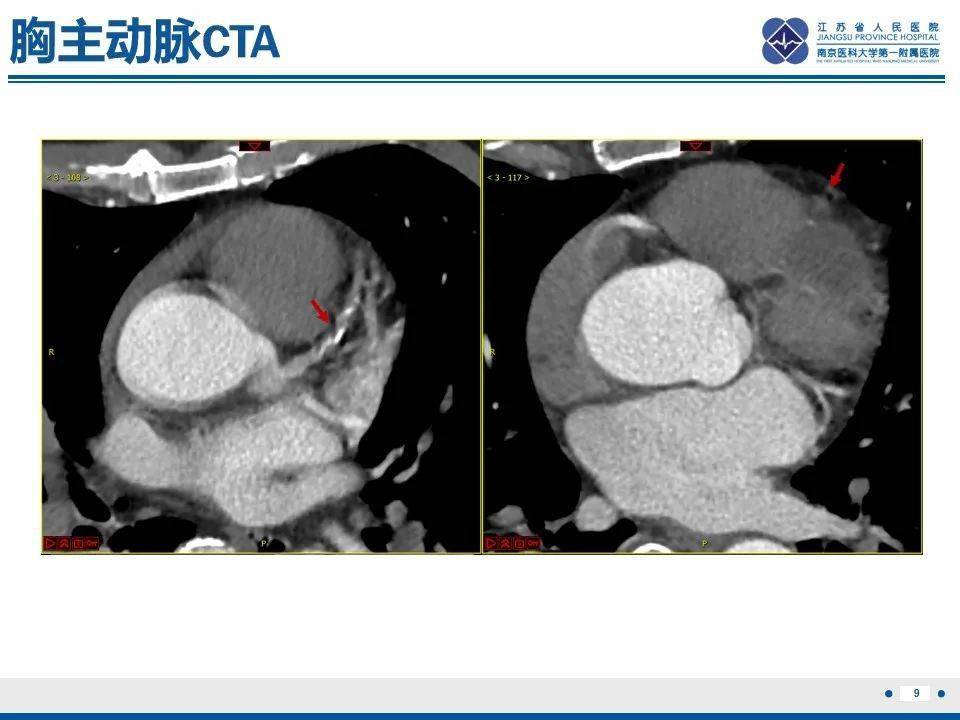 心肌纵断面图片