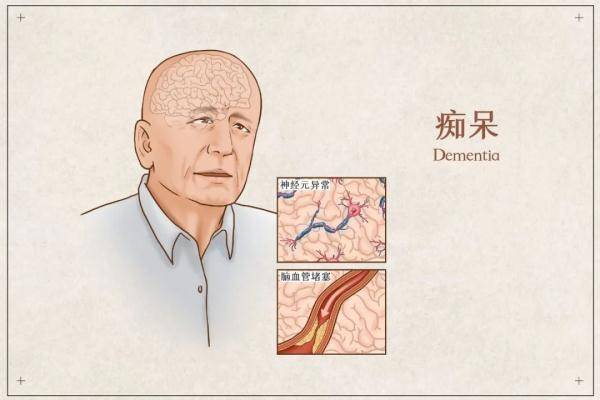 饮食|发胖有个“分水岭”，过了这个年纪很多人都容易胖！要注意了！