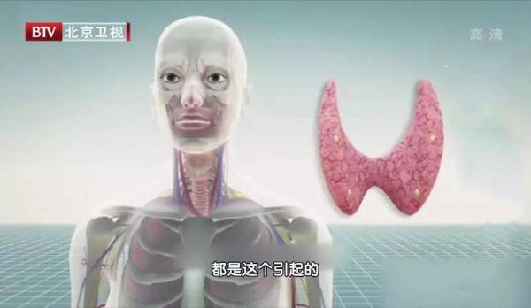 太子参|当心！3种舌象，可能提示甲状腺疾病！