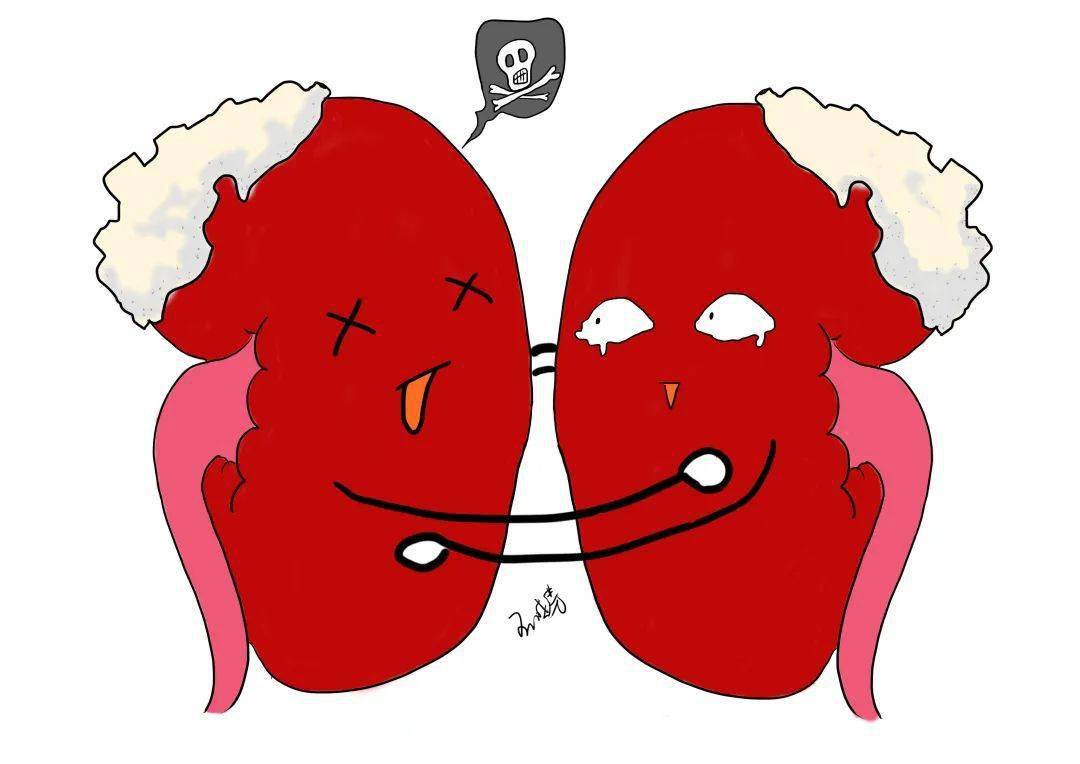 石头也疯狂~一颗肾结石的历险记……(下)