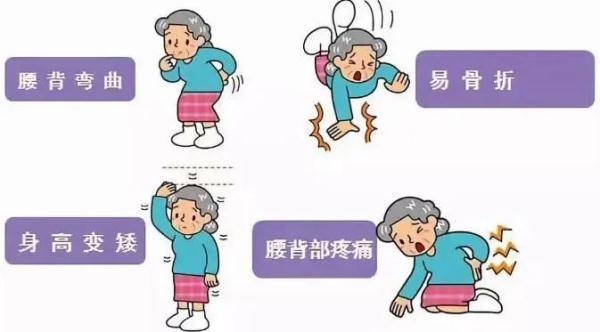 骨骼|大二男生掰手腕时粉碎性骨折！你的骨头没想象的那么“硬”