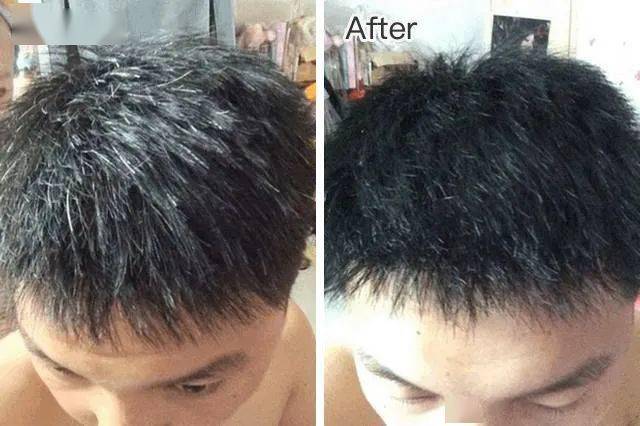 什么方法可以让头发不变白 6209733f047f4efb80fa772fa9904ad3.jpeg