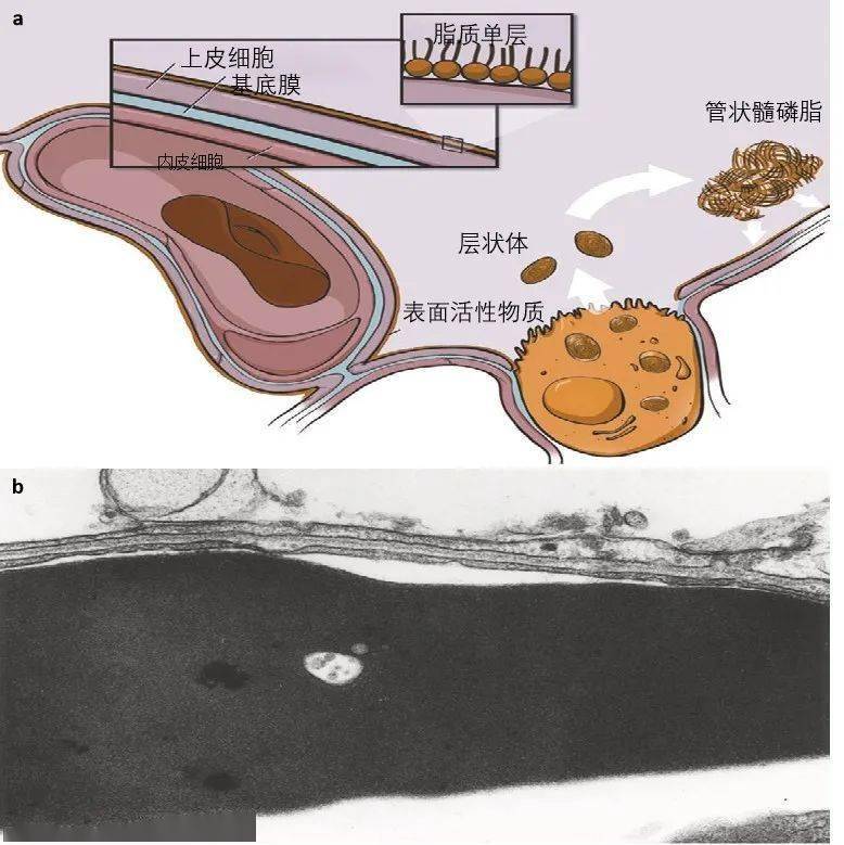 心胸聯合手術的麻醉管理(上海市胸科醫院麻醉科)_肺泡