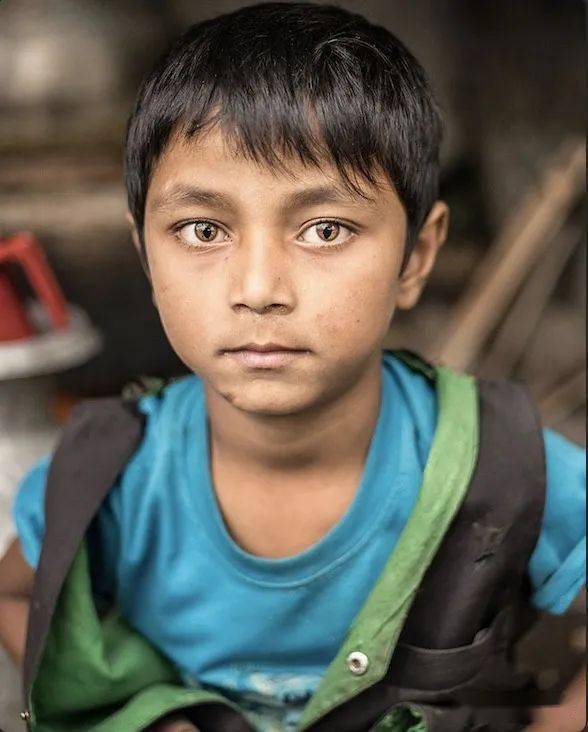 人体那些罕见的遗传变异看完简直感慨基因太神奇