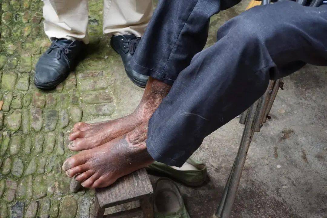 为丽水这群医师点赞!_白翼