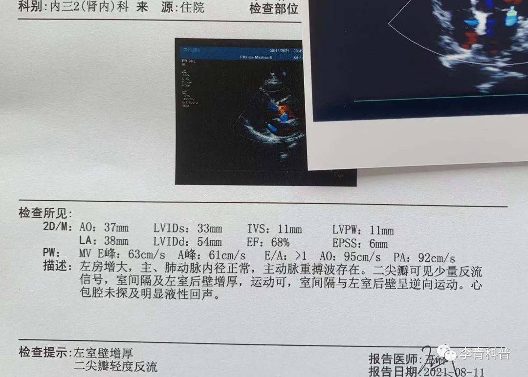 治疗|43岁严重糖尿病肾病、眼底出血,他的错误许多人还在重复!