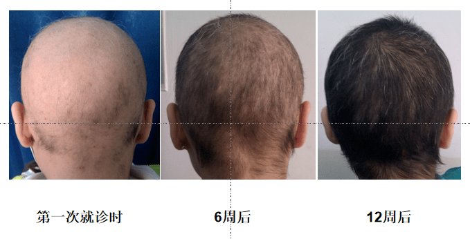 致敬中國醫師節:臨沂市人民醫院皮膚科主任熊瑛:解決