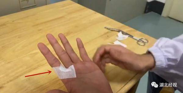 伤口|痛心！3岁女童小伤却被截掉手指！只因做错了这件事