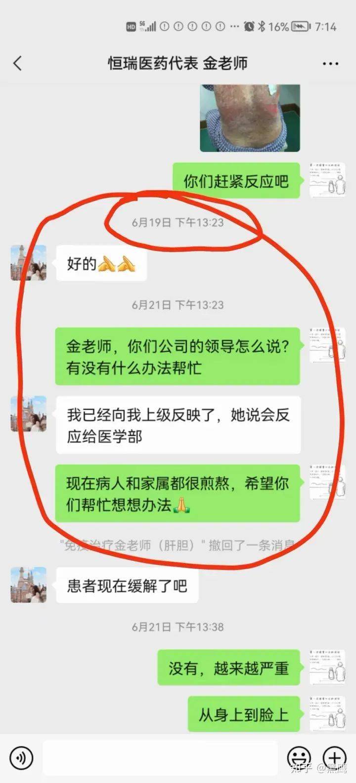 针剂|抗癌药PD-1又惹祸，恒瑞医药的明天在哪？