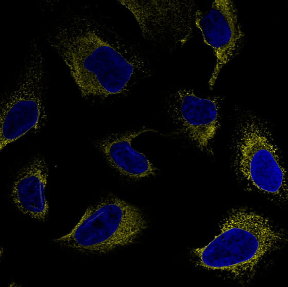 核蓝色:细胞核黄色和绿色重合的位置,就是内质网和高尔基的共同定位
